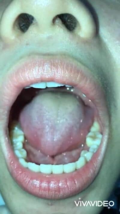Student girl mouth after drink cum